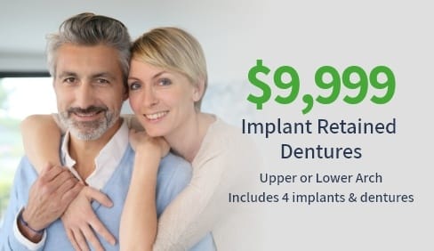 Implant Dentures special coupon