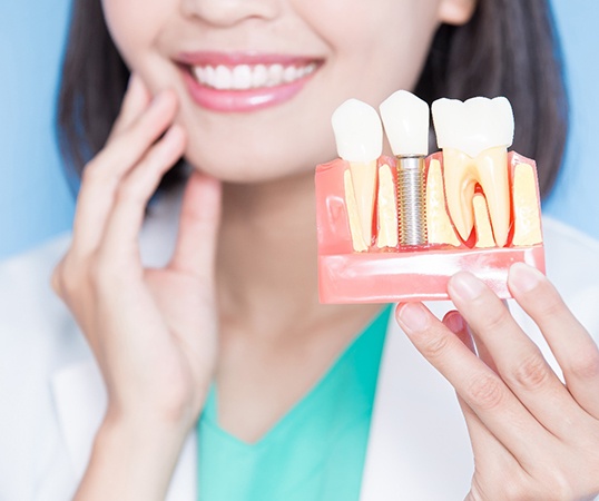 A dentist holding a dental implant model in her hand