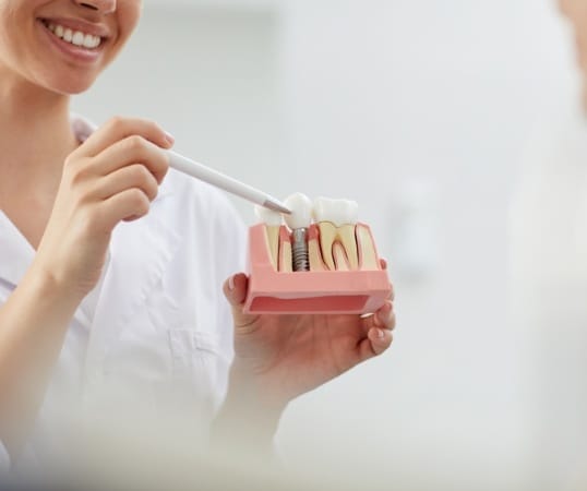 Dentist showing patient model of dental implant supported dental crown
