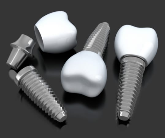 Three animated dental implant supported dental crowns