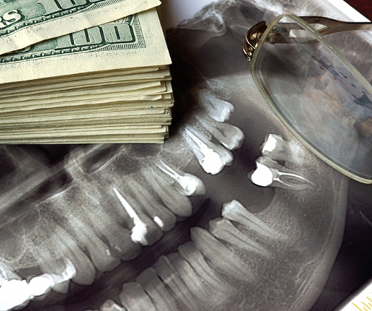 stack of money on top of dental X-rays