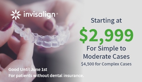 Invisalign special coupon