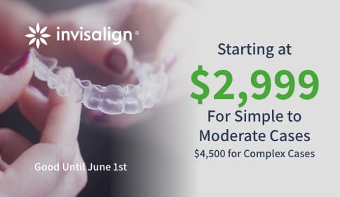 Invisalign special coupon