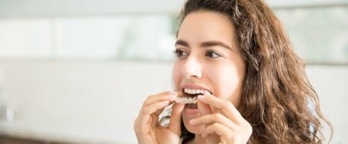 Invisalign special coupon