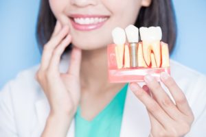 a dentist smiling and showing a replica of a dental implant